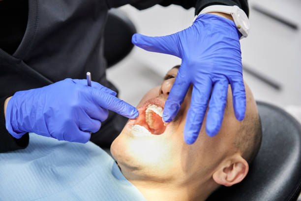 Best Emergency Dental Care for Abscessed Tooth in Centerville, IA